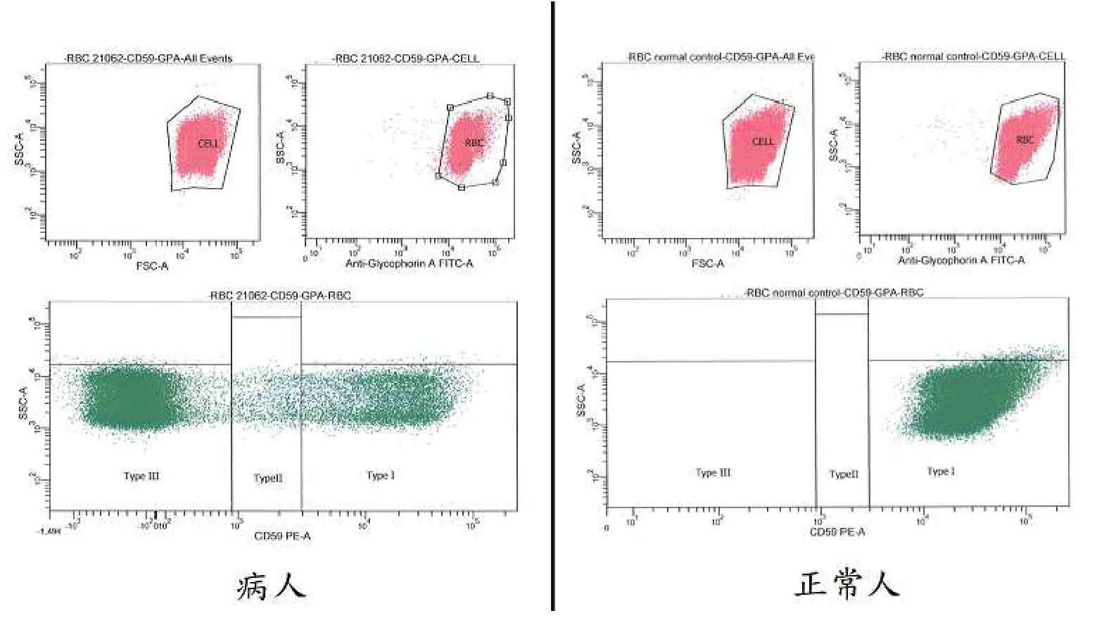 113 第1次 臨床血液學與血庫學 第 1 題 題目圖片