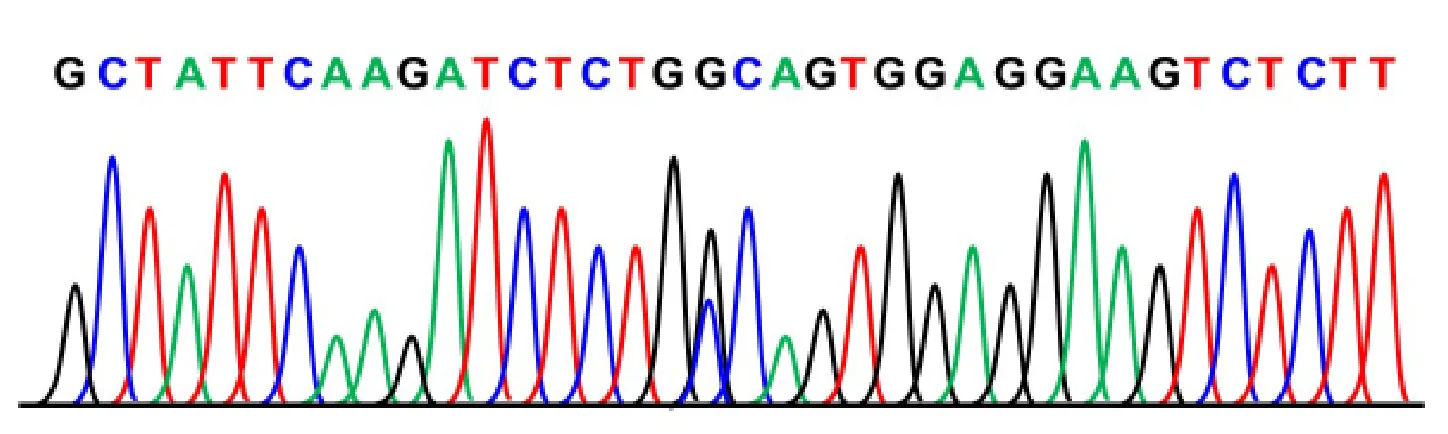 113 第1次 醫學分子檢驗學與臨床鏡檢學（包括寄生蟲學） 第 59 題 選項 A 圖片