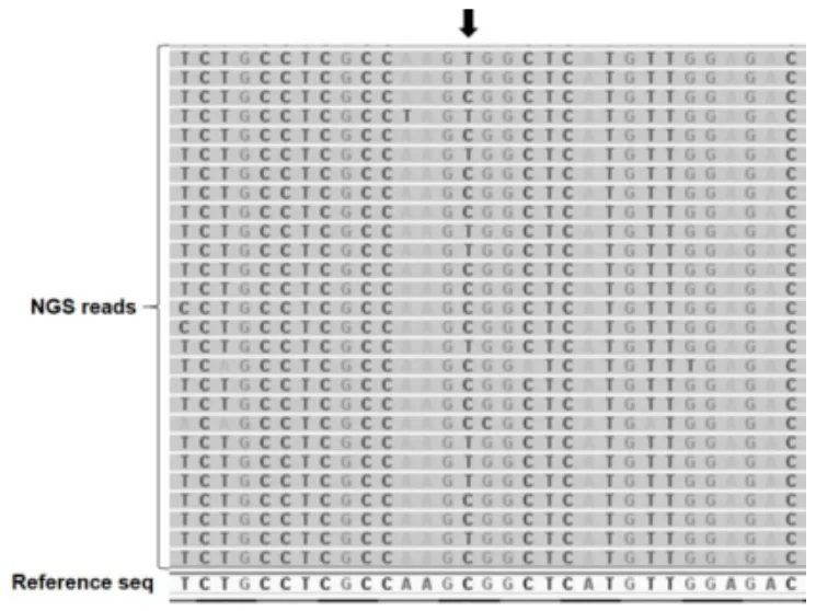 113 第1次 醫學分子檢驗學與臨床鏡檢學(包括寄生蟲學) 第 60 題 題目圖片