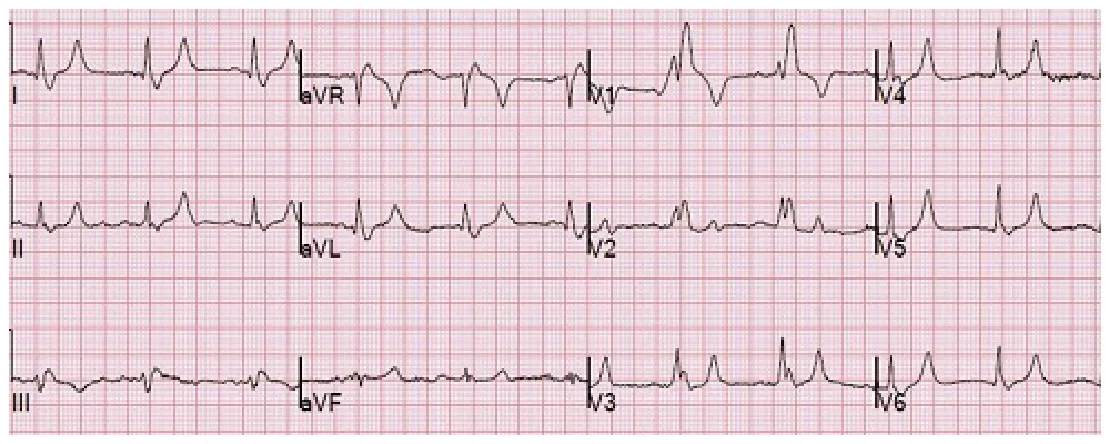 113 第1次 臨床生理學與病理學 第 5 題 題目圖片