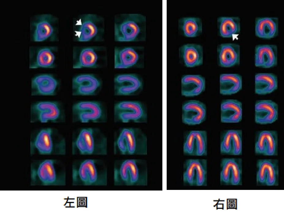 113 第2次 醫學（三） 第 14 題 題目圖片
