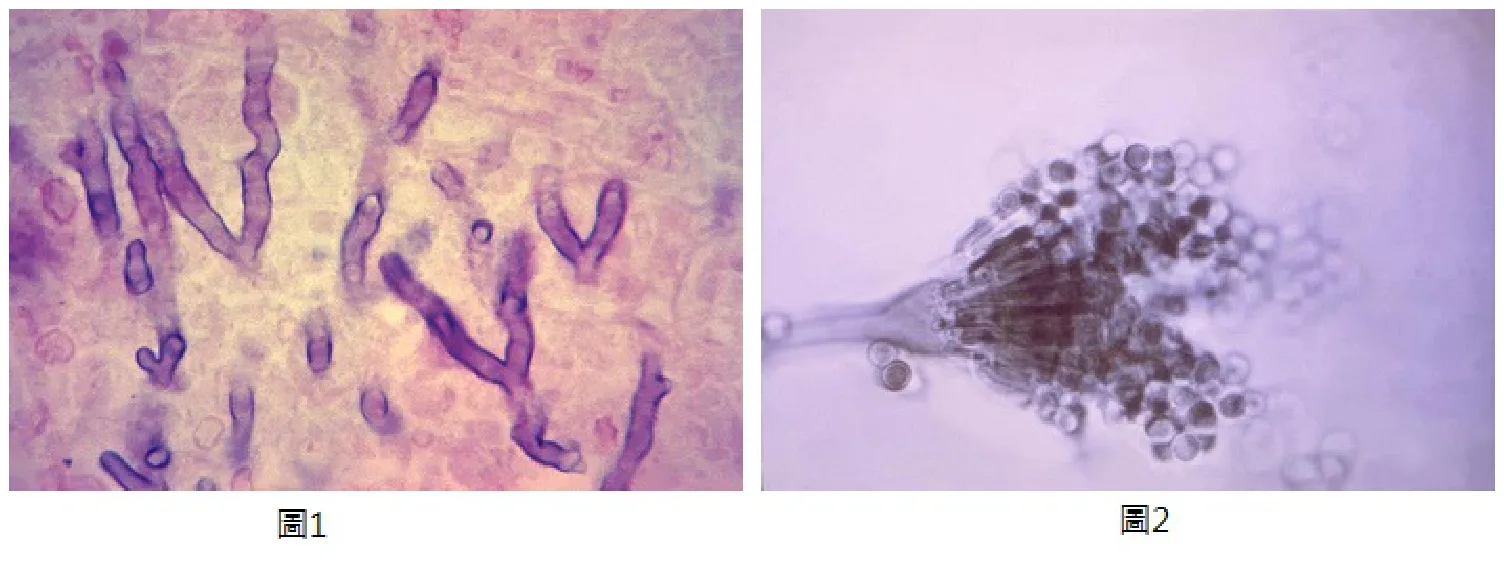 113 第2次 微生物學與臨床微生物學（包括細菌與黴菌） 第 65 題 題目圖片