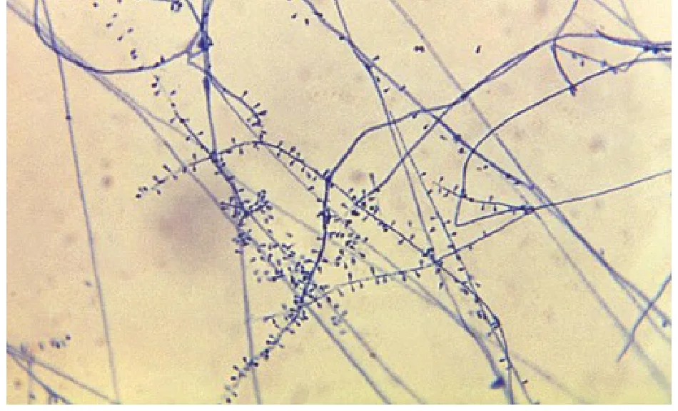 113 第2次 微生物學與臨床微生物學（包括細菌與黴菌） 第 68 題 題目圖片
