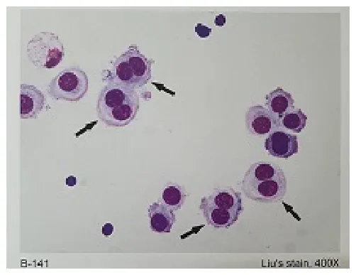 113 第2次 醫學分子檢驗學與臨床鏡檢學（包括寄生蟲學） 第 21 題 題目圖片