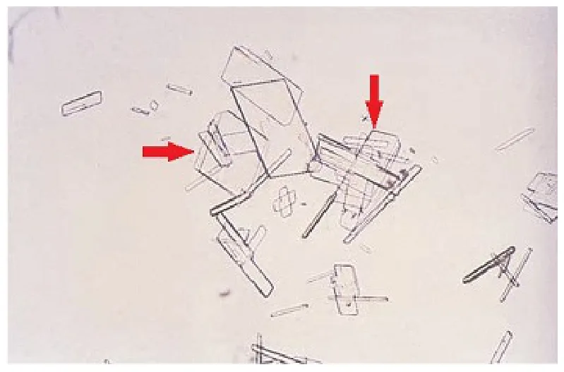 113 第2次 醫學分子檢驗學與臨床鏡檢學（包括寄生蟲學） 第 38 題 題目圖片