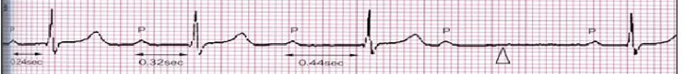 114 第1次 心肺疾病與小兒疾病物理治療學 第 19 題 題目圖片