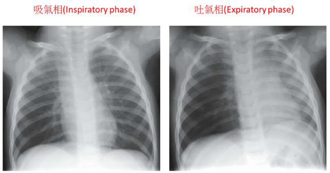 114 第1次 醫學(六) 第 25 題 題目圖片