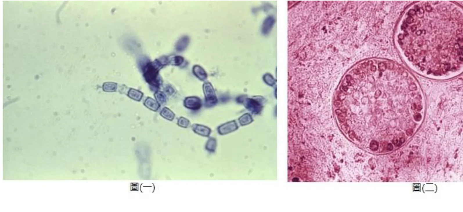 114 第1次 微生物學與臨床微生物學（包括細菌與黴菌） 第 65 題 題目圖片