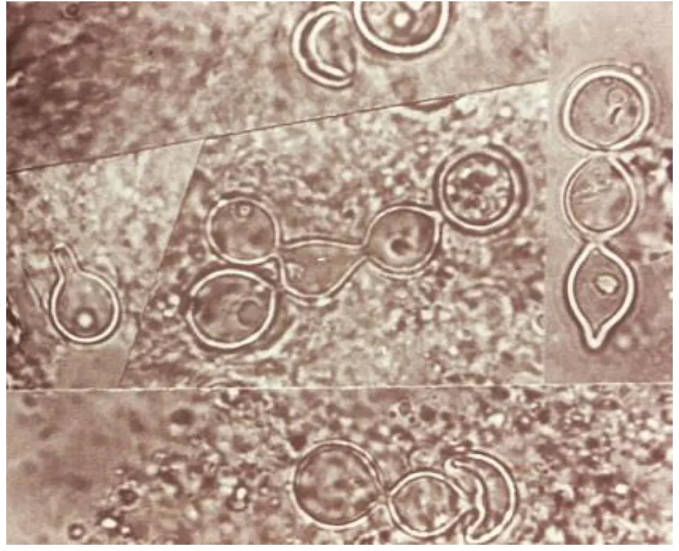114 第2次 微生物學與臨床微生物學(包括細菌與黴菌) 第 65 題 題目圖片