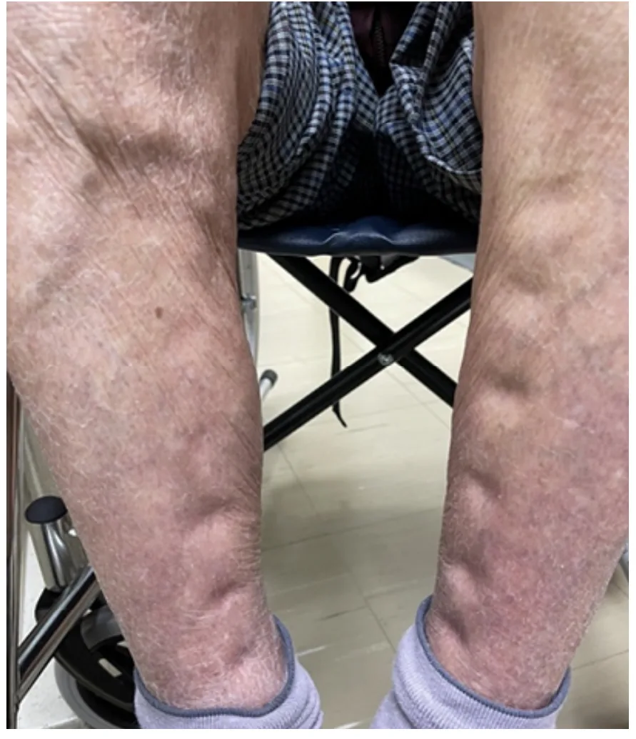 115 第2次 調劑學與臨床藥學 第 53 題 題目圖片