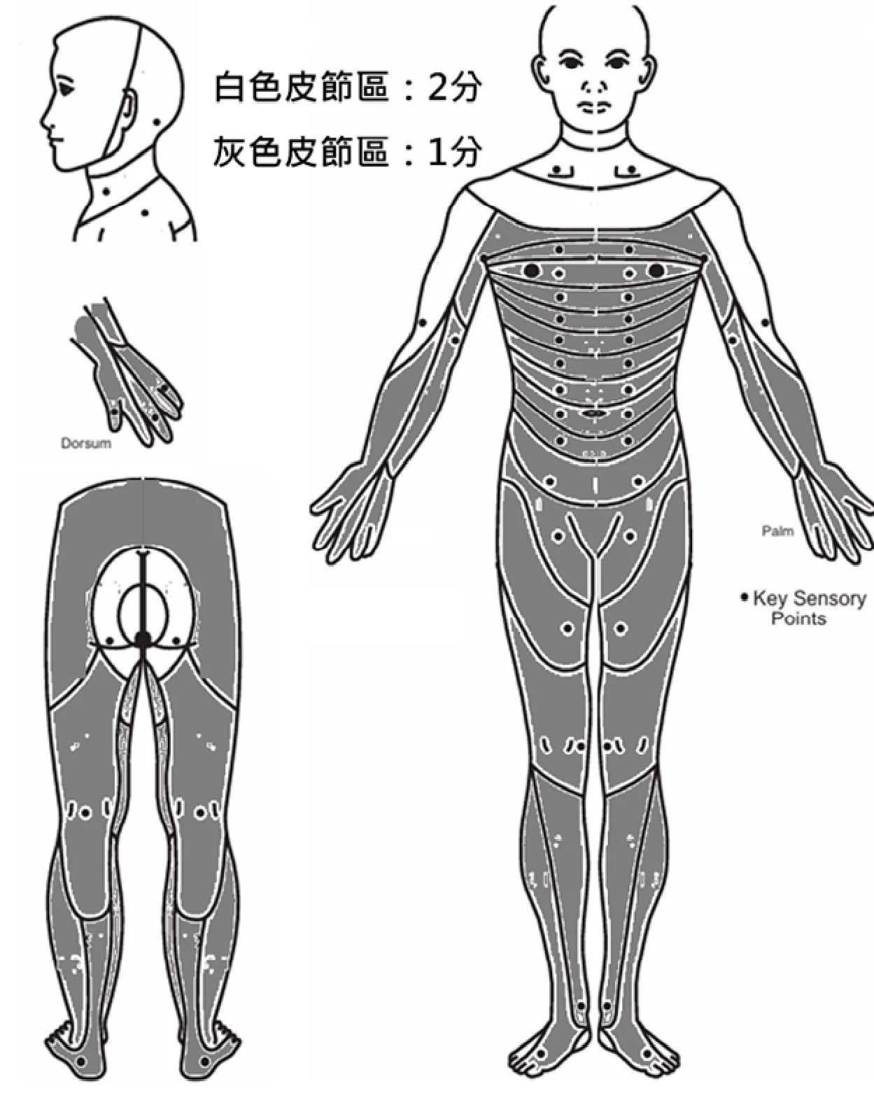 115 第2次 神經疾病物理治療學 第 55 題 題目圖片